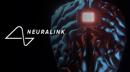 El humano no verbal está abierto a la comunicación: Neuralink ha realizado la tercera cirugía exitosa para implantar un chip en el cerebro de un paciente