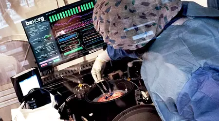 Cerebros donados para la ciencia: el startup que acelera la búsqueda de fármacos contra el Parkinson