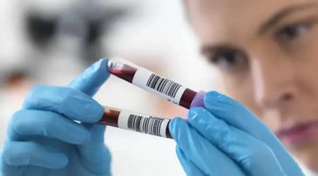 Científicos chinos crean un análisis de sangre con inteligencia artificial que diagnostica enfermedades 15 años antes de que aparezcan los síntomas