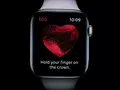post_big/ECG-patent-infringement-claim.jpg