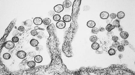 Un laboratorio australiano pierde virus peligrosos por un fallo en el congelador