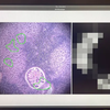 Google y el Pentágono han desarrollado un microscopio basado en inteligencia artificial para el diagnóstico del cáncer-6 Google y el Pentágono han desarrollado un microscopio basado en inteligencia artificial para el diagnóstico del cáncer-6