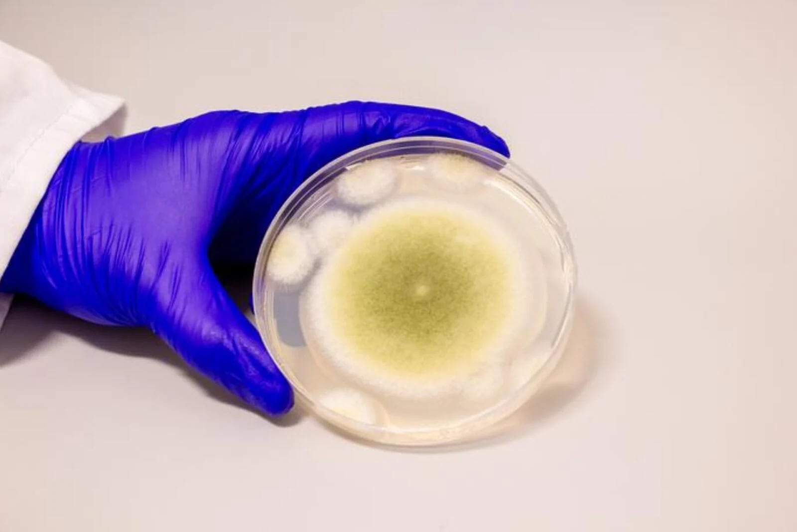 Aspergillus flavus: innovaciones potenciales y riesgos para la salud Aspergillus flavus: un hongo con potencial tecnológico y desafíos