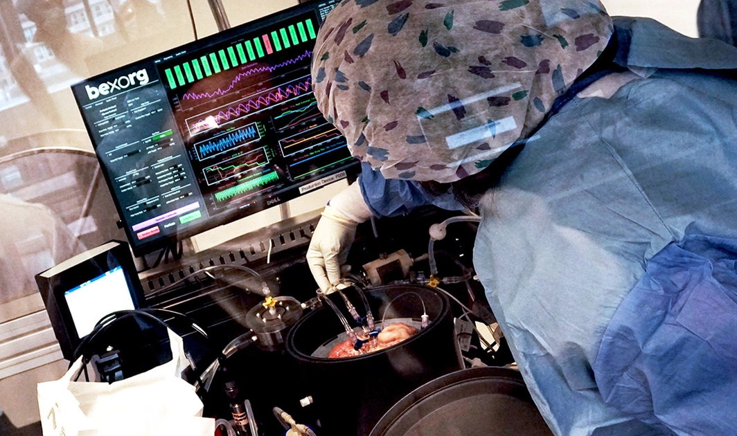 Cerebros donados para la ciencia: el startup que acelera la búsqueda de fármacos contra el Parkinson