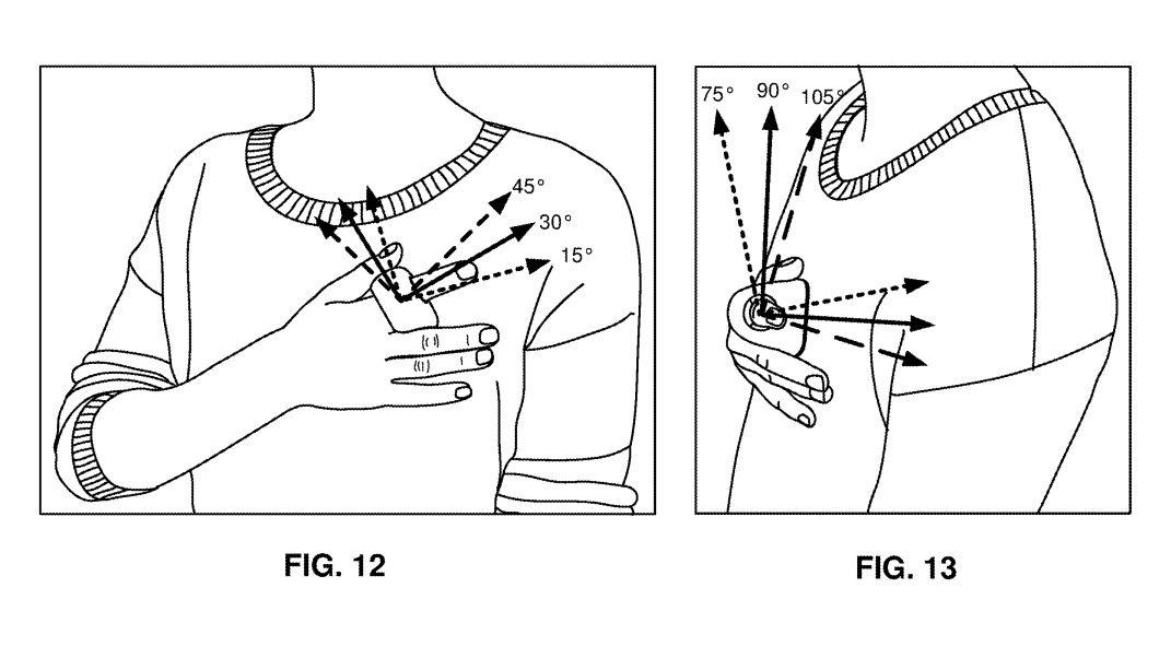Patente del dispositivo Fitbit Patente de un dispositivo Fitbit para medir la presión arterial en el dedo