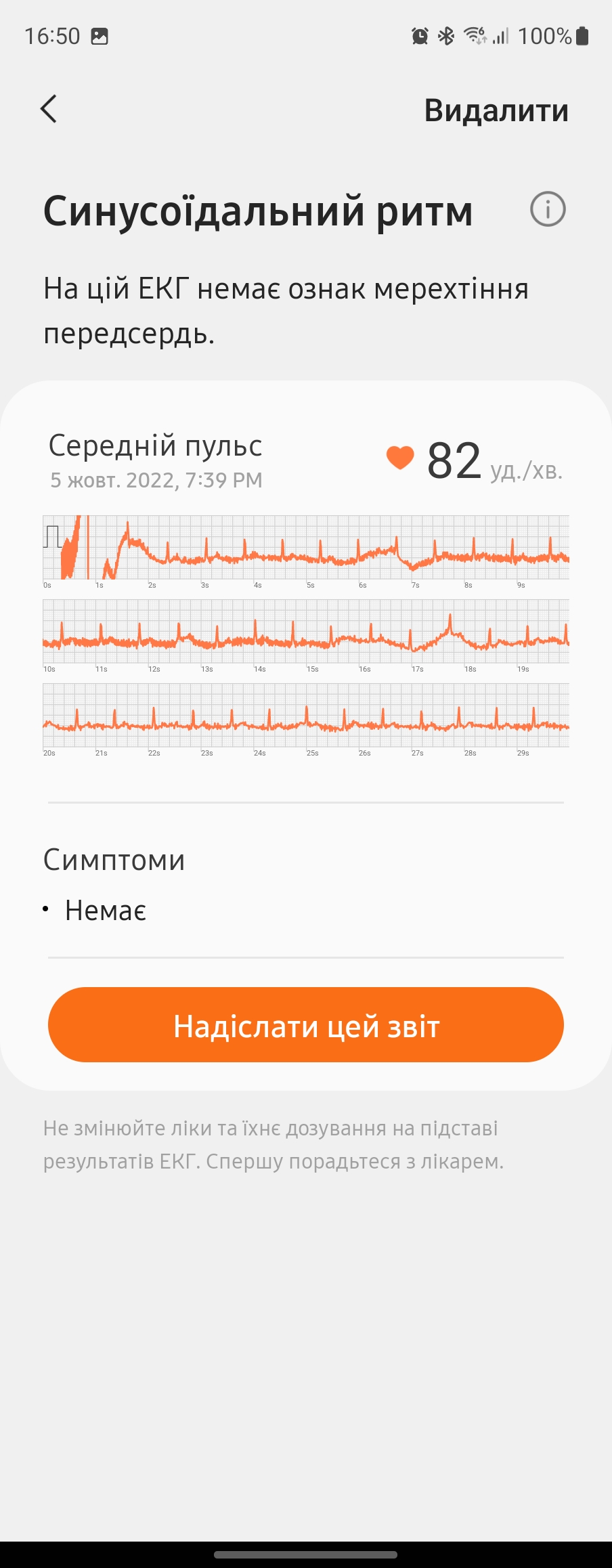 Análisis del Samsung Galaxy Watch5 Pro y Watch5: más duración de la batería, menos bisel físico-229 Análisis del Samsung Galaxy Watch5 Pro y Watch5: más duración de la batería, menos bisel físico-229